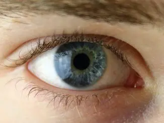 Kontaktlinsen