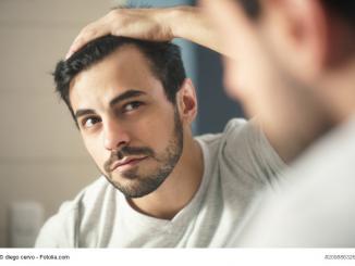 Haartransplantation Methoden