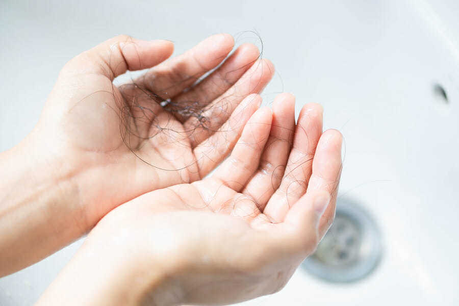 Haarausfall bei einer Traktionsalopezie