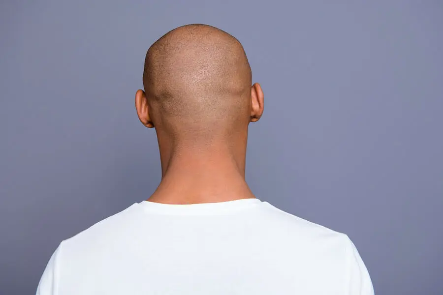 Softlasertherapie und Haartransplantation