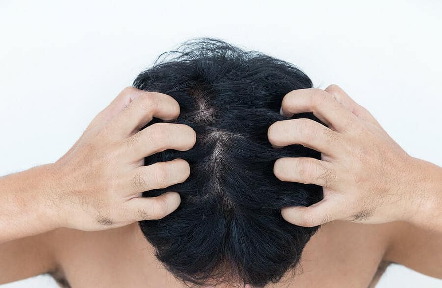 Haare kopfhaut sichtbar dünne Tipps für