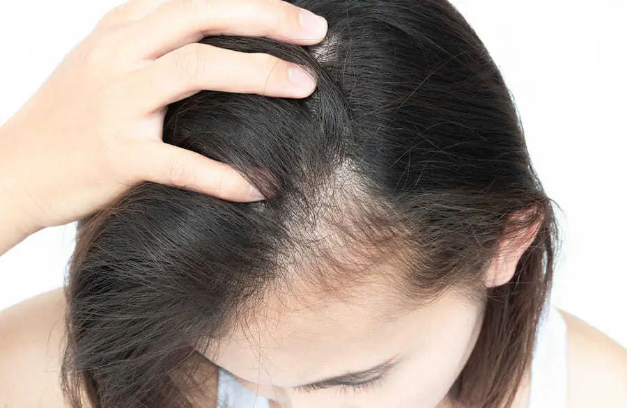 Wirkung der Softlasertherapie gegen Haarverlust
