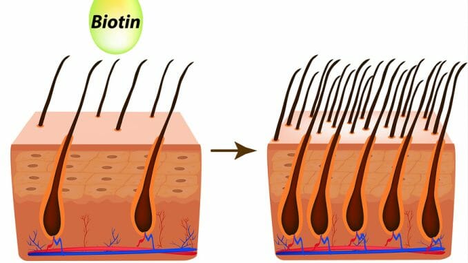 Biotin bei Haarausfall Biotin bei Haarverlust