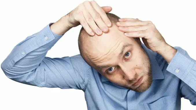 Haarausfall mit Wurzel Haarausfall mit Wurzel