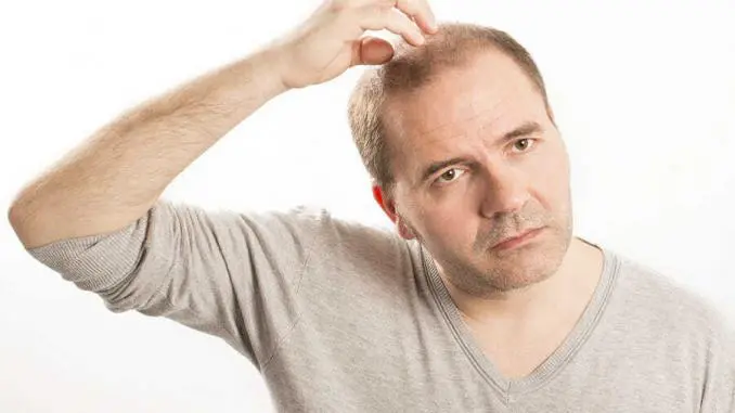 Pflanzliches Mittel gegen Haarausfall Pflanzliches Mittel gegen Haarausfall
