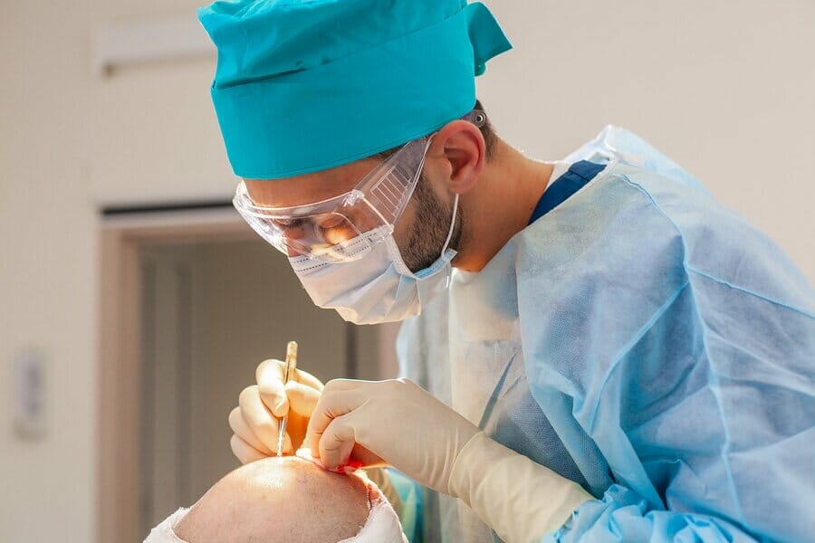 Vorteile der Perkutan Haartransplantation Methode