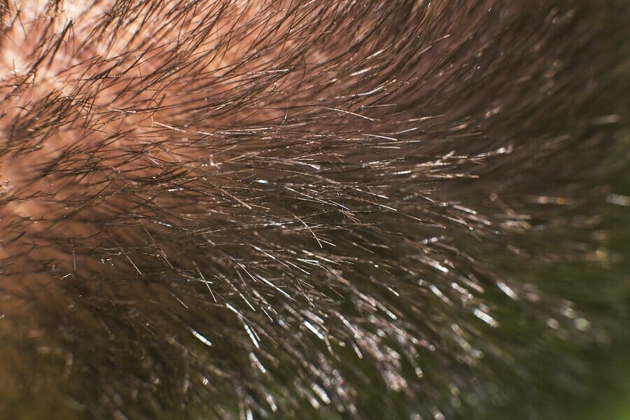 Neues Haar sprießt