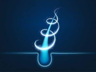 NEO FUE Haartransplantation