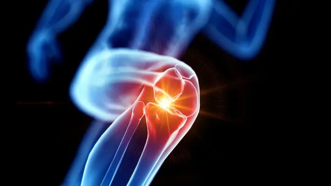 CBD-Öl bei Arthrose CBD-Öl bei Arthrose