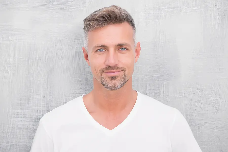 Geheimratsecken Haartransplantation