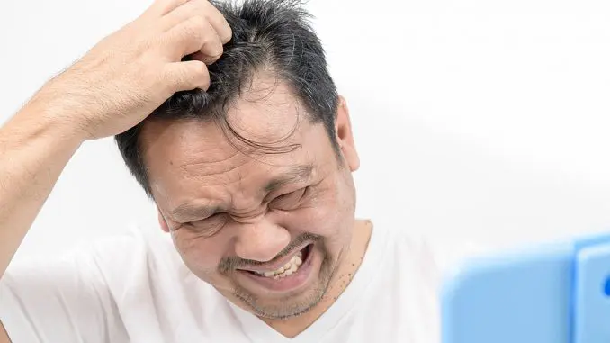 Haarausfall und juckende Kopfhaut Haarausfall und juckende Kopfhaut