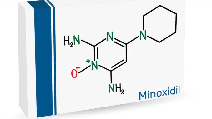 Minoxidil bei Geheimratsecken