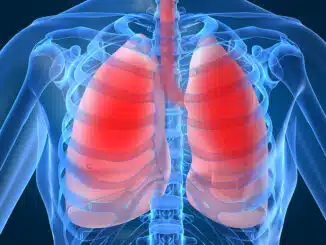 Lungenembolie