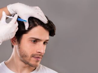 Eine medizinische Fachkraft mit Handschuhen setzt eine Injektion in die Kopfhaut eines Mannes.