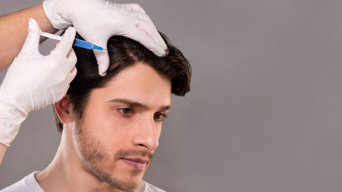 Eine medizinische Fachkraft mit Handschuhen setzt eine Injektion in die Kopfhaut eines Mannes.